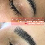 اصلاح صورت و ابرو