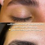 اصلاح صورت و ابرو