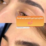 اصلاح صورت و ابرو