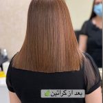 تراپی مو