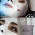فیشیال صورت