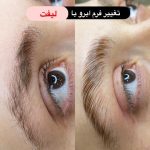 لیفت مژه و ابرو