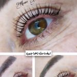 لیفت مژه و ابرو