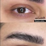 لیفت مژه و ابرو