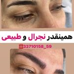 میکروبلیدینگ و فیبروز ابرو