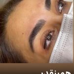 میکروبلیدینگ و فیبروز ابرو