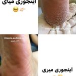 پدیکور و مانیکور