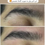 اصلاح صورت و ابرو