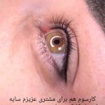 خط چشم و بن مژه دائم