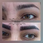 میکروبلیدینگ و فیبروز ابرو