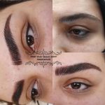 میکروبلیدینگ و فیبروز ابرو
